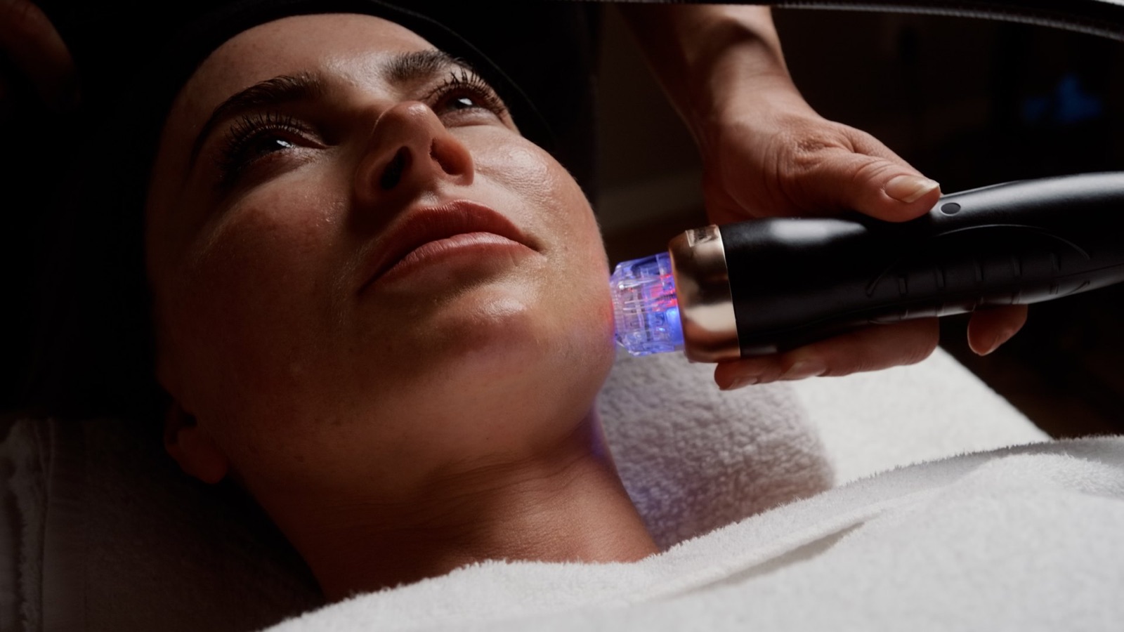 RF Microneedling-behandling i ansigtet